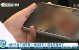 你會(huì)用小拇指托住手機(jī)嗎？醫(yī)生提醒要注意這些縮略圖